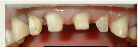 <p>adv of rounded shoulder? (3)</p><p>dis (1)</p>