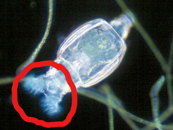 What is this structure of a rotifer?