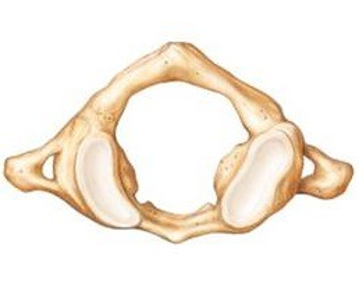 <p>- first cervical vertebra (C1)</p><p>- no body</p><p>- large vertebral foramen</p><p>- articulates with the skull</p><p>- has no spinous process</p>