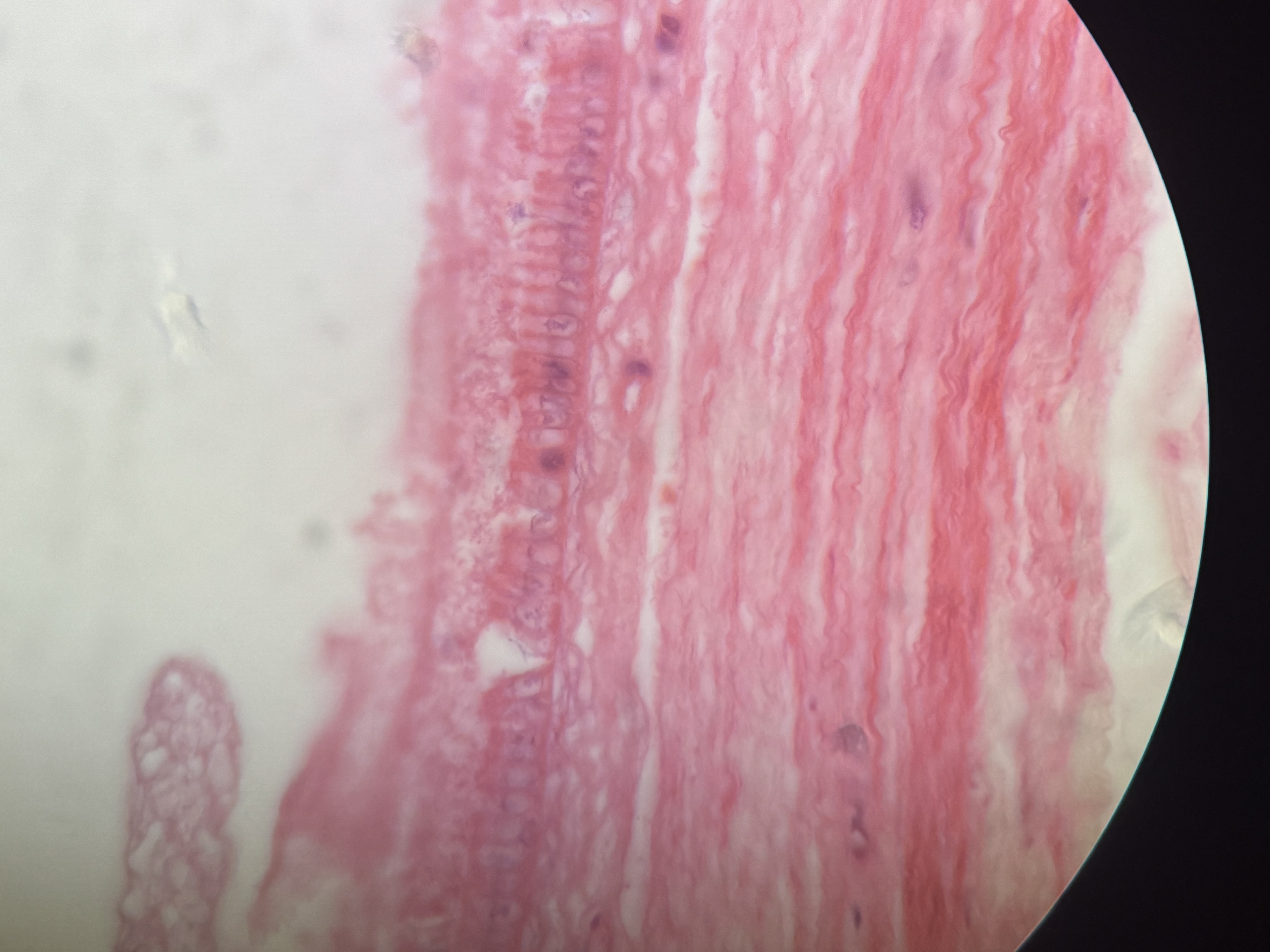 <p>single layer of rectangular cells oval nuclei,, some have cillia,, goblet mucus</p>
