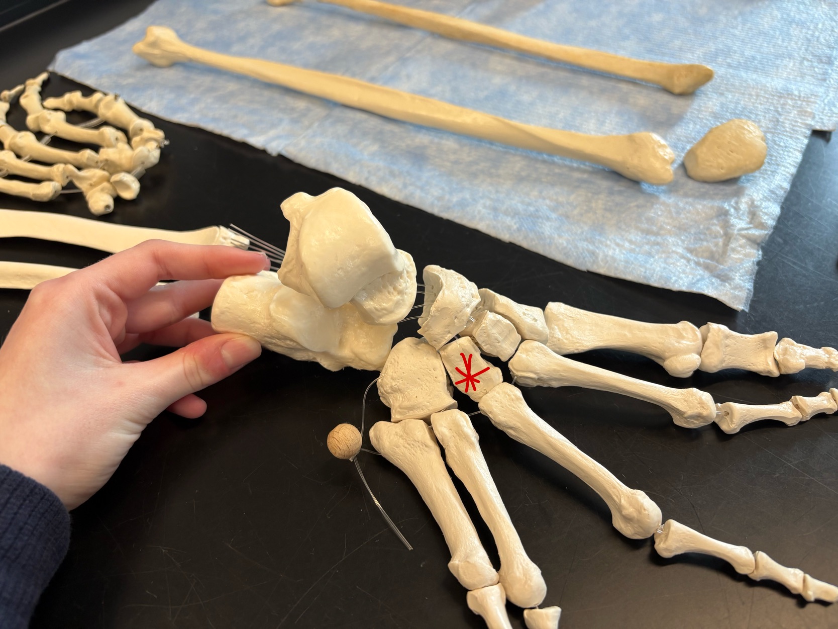 <p>Name this bone</p>