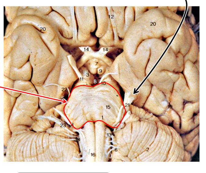<p>IGNORE THE RED ARROW but what is the black arrow pointing at</p>