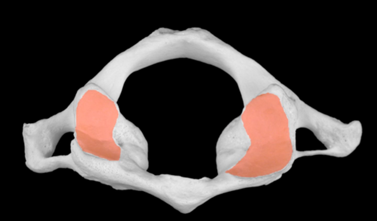 <p>surface for occipital condyle articulation</p><p>'yes movement'</p>