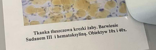 <p>mają dużą kroplę tłuszczu i są ściśle upakowane co pozwala im na fukcję ochronną oraz bycie magazynem energii </p>