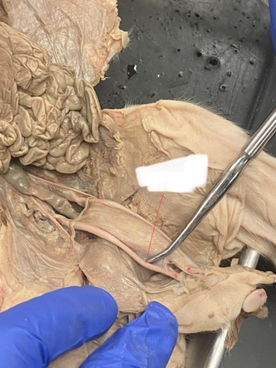 <p>Umbilical arteries</p>