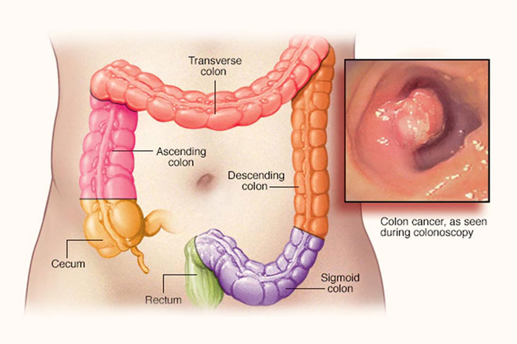 What are the 6 segments of the **large intestine?**