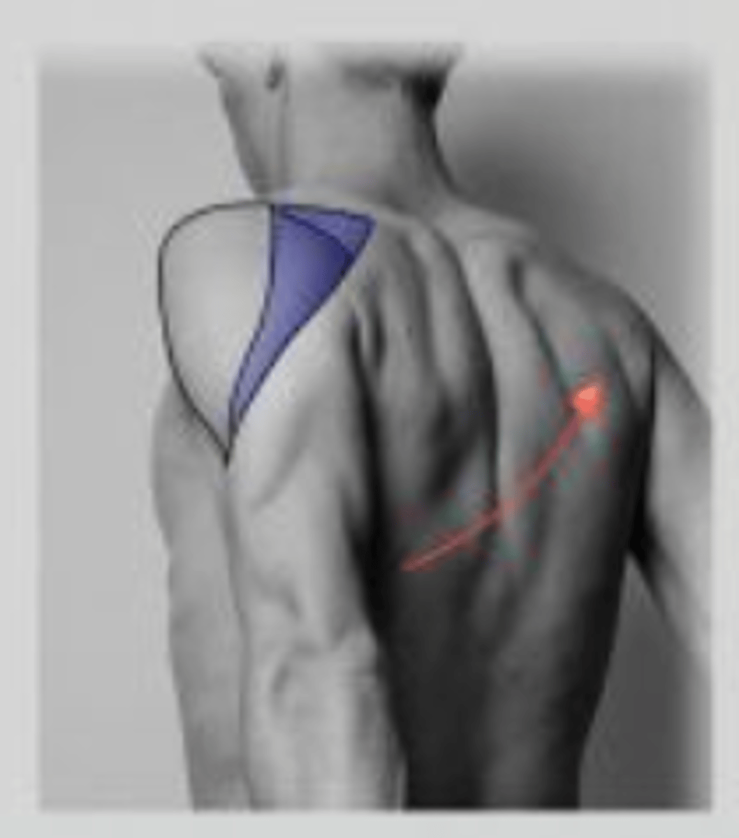 <p>extension in sagittal plane; "I" motion</p>