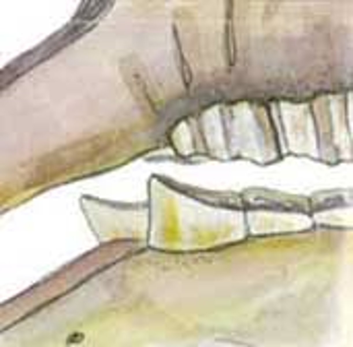 <p>What is the pathology?</p>