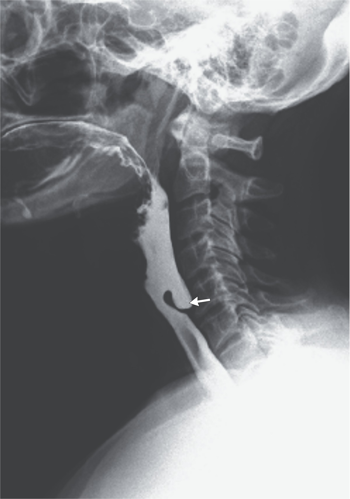 <p>What pathology is shown here?</p>