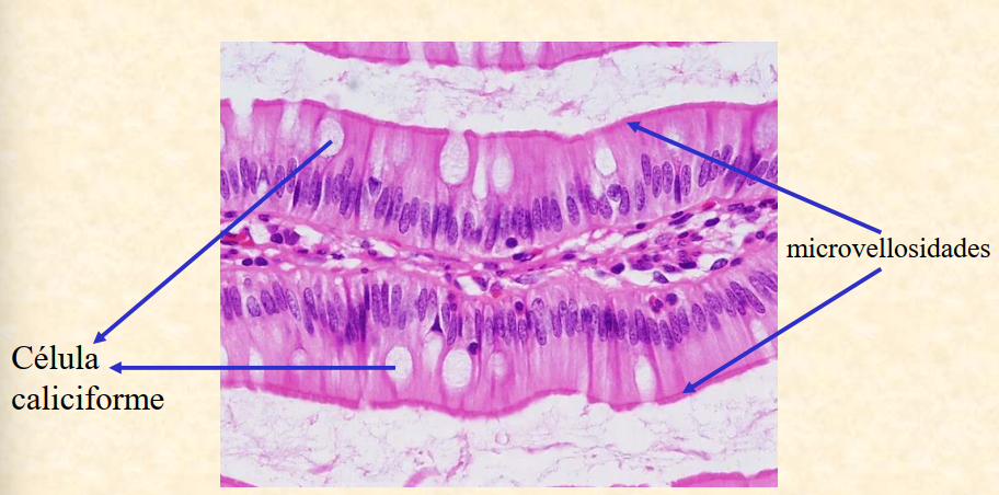 <ul><li><p>E. S. Cilíndrico con Microvellosidades cortas y Células Caliciformes</p><ul><li><p>Localización: tracto digestivo, intestino delgado y estómago</p></li><li><p>Función: <strong>células caliciformes glandulares</strong> son un tipo de célula cilíndrica simple que funciona para secretar <strong>mucinas</strong></p></li></ul></li></ul><p></p>