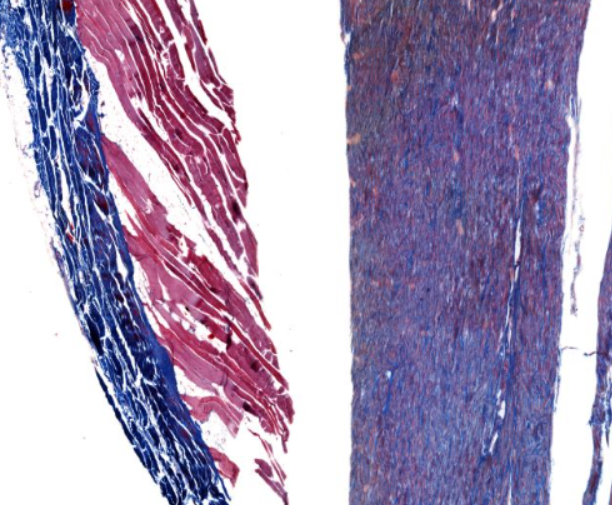 <p>Collagen stains blue and elastin stains red</p>