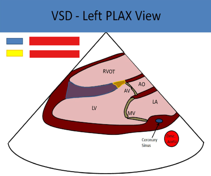 <p>what vsds are pictured</p>
