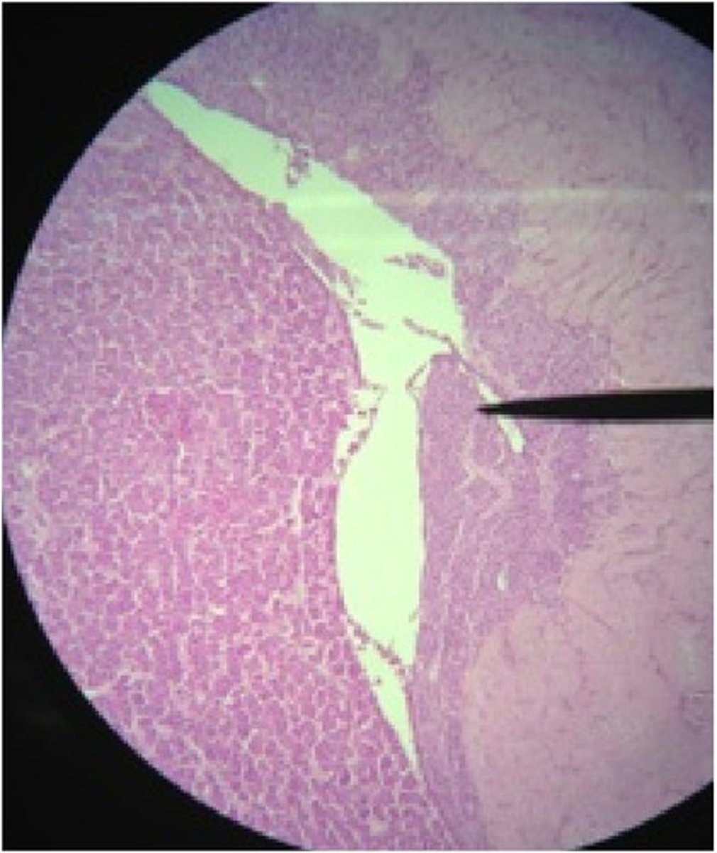 <p>A. Label B. Hormones STORED there</p>