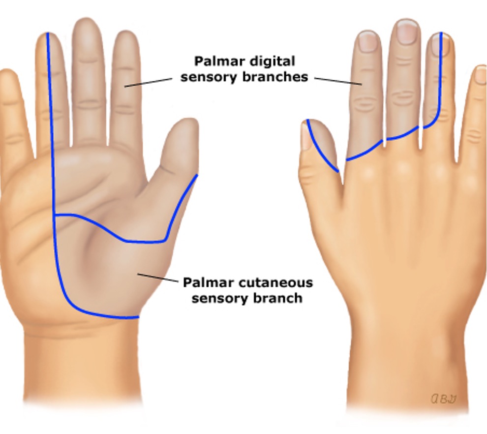 <p>what condition?</p><ul><li><p>compression of the median nerve as it travels through the carpal tunnel</p></li><li><p>pain or paresthesia - first 3 digits and radial half of 4th</p></li><li><p>worse at night; provoked by flexing/extending wrist or raising arms</p></li><li><p>alternating remission and exacerbation</p></li><li><p>F &gt; M</p></li></ul><p></p>