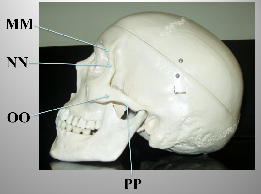 <p>What structure is letter PP?</p>