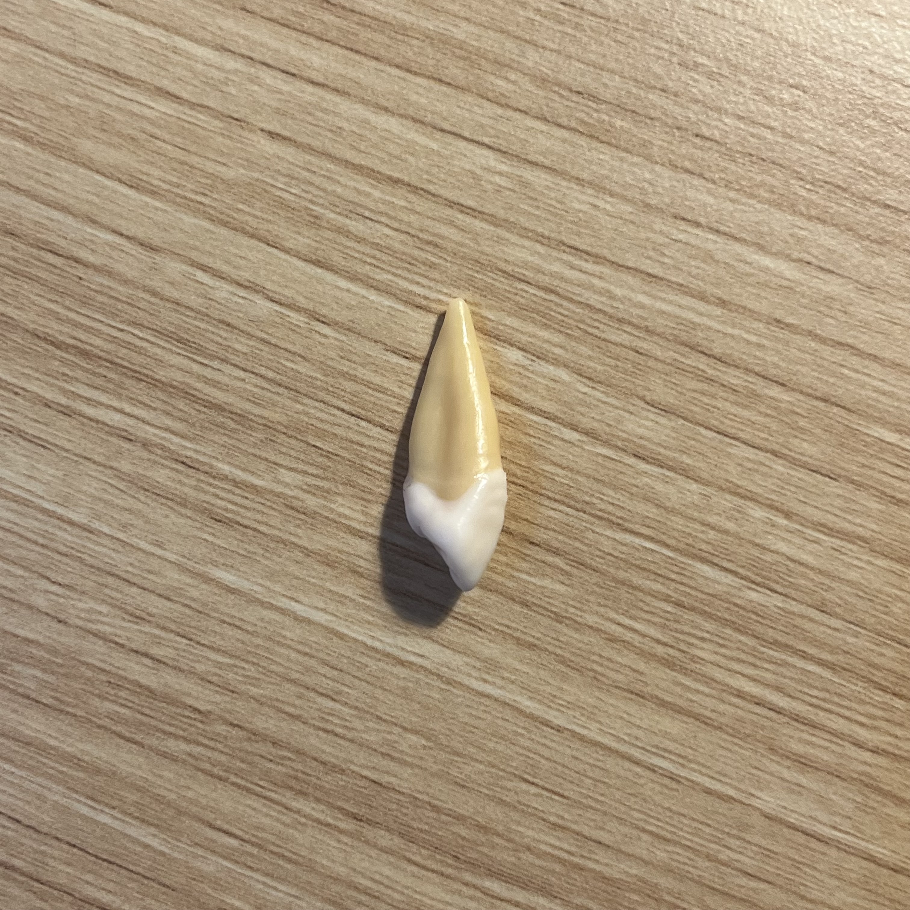 <p>What tooth is this (with view)?</p>