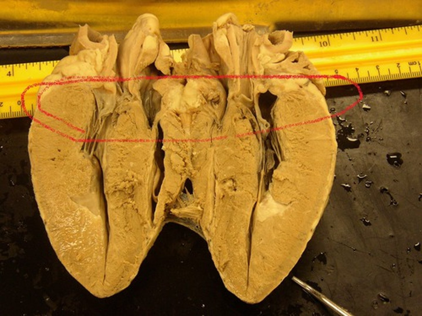 <p>top region of the heart</p>