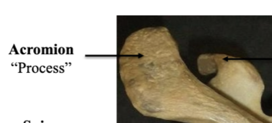 <p>Acromion Process </p>