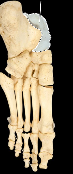 <p>Bones of the foot, inferior view, left side</p>