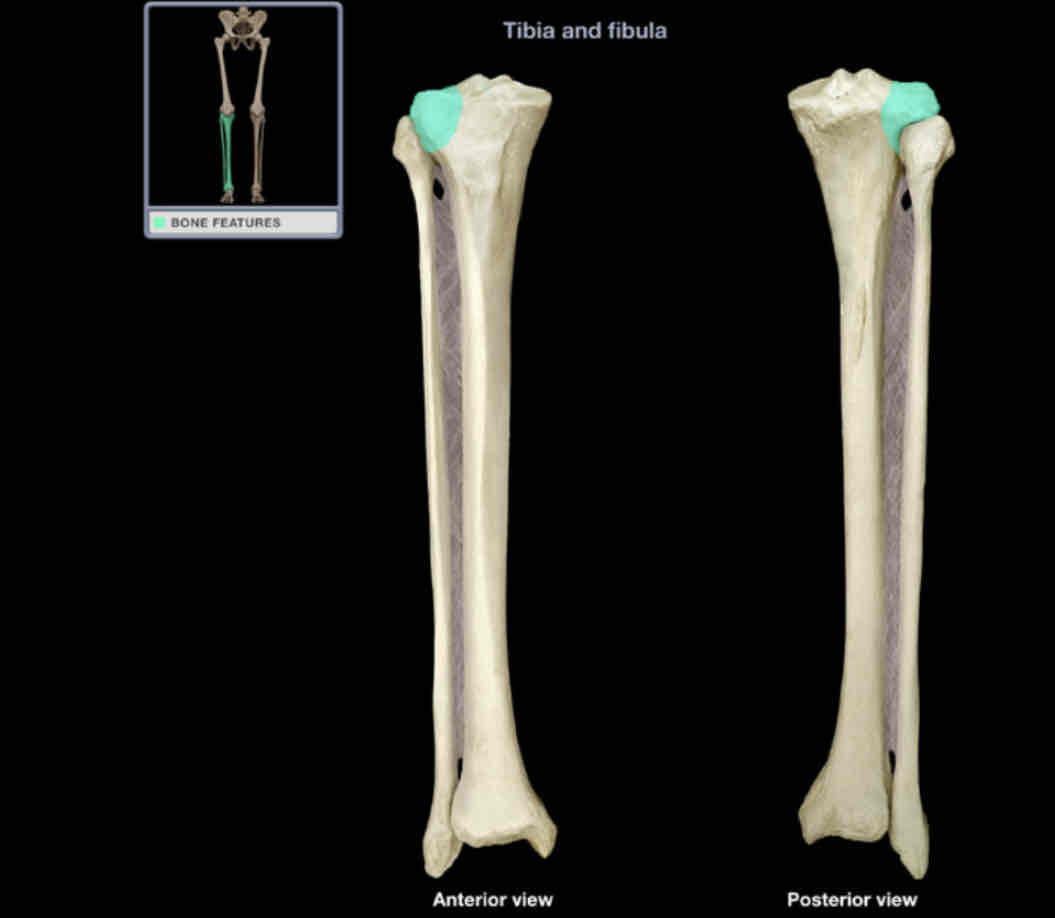 <p>Lateral condyle of tibia</p>