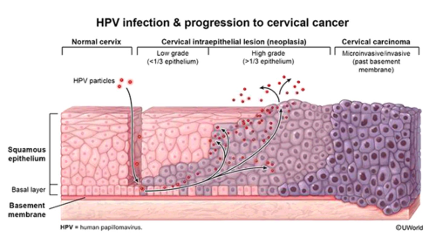 <p>1)tear/wound of the epidermis</p><p>2)HPV infects basal cells</p><p>3)tear/wound heals</p><p>4)basal cells differentiate into squamous cells and move up</p><p>5)HPV virions amplify as cells are pushed from the basal layer and differentiate</p>