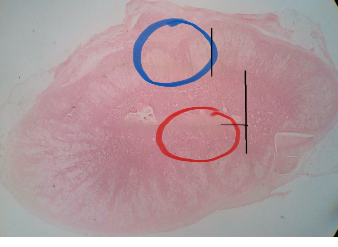 <p>Adernal Cortex</p>