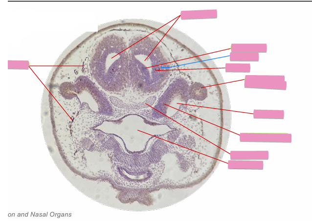 <p>what level<br>primary brain vesicle<br>parts</p>
