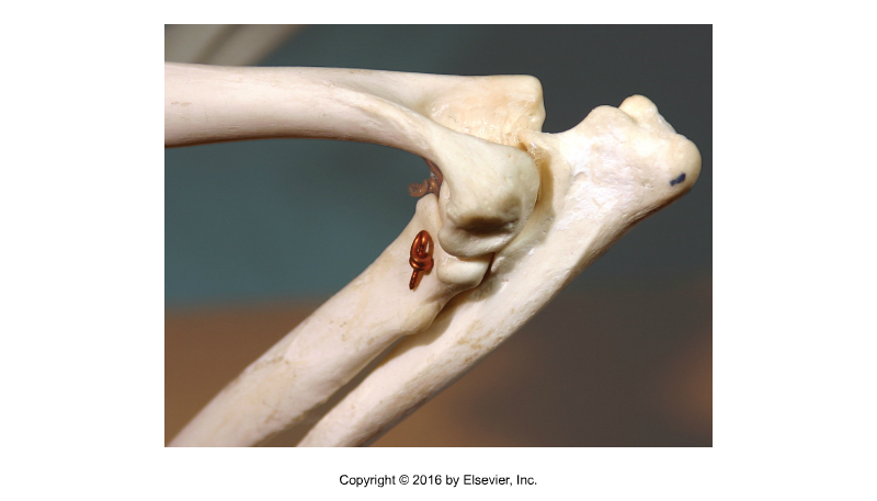 <p>Type of Joint?</p>