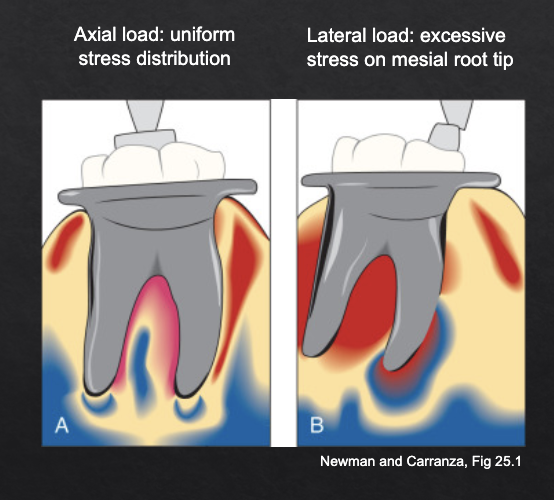 <p>axial with limited lateral component</p>