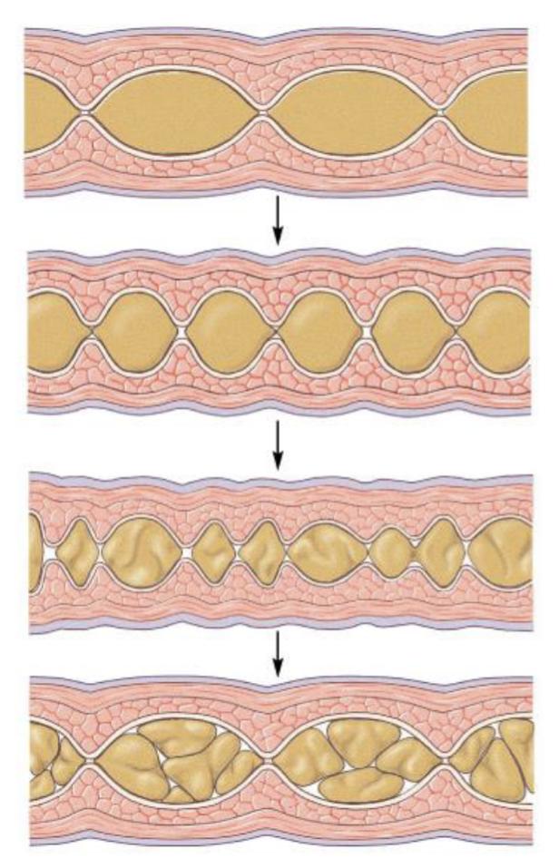 <p><span><span>Segmentation</span></span></p>