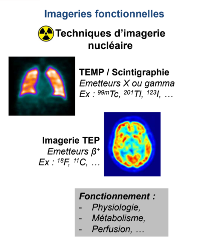 <p>Les imageries fonctionnelles ou moléculaires font toutes appel à des rayonnements ionisants. Elles ne donnent pas vraiment d’informations sur la taille, la morphologie, le volume des organes mais sur leur <strong>fonctionnement</strong>. Chaque médicament qu’on administre vont permettre de visualiser un <strong>processus biochimique ou métabolique particulier. </strong><span style="color: #838282"><em>Ce sont donc globalement des techniques qui ont une résolution spatiale pas terrible.</em></span></p><p><em><u>Ex</u> : Si j’injecte du fluoro-déoxyglucose radiomarqué au fluor 18, je vais pouvoir faire de l’imagerie TEP et voir la consommation cérébrale de glucose plus précisément l’activité des transporteurs GLUT dans les différentes zones du cerveau</em></p>
