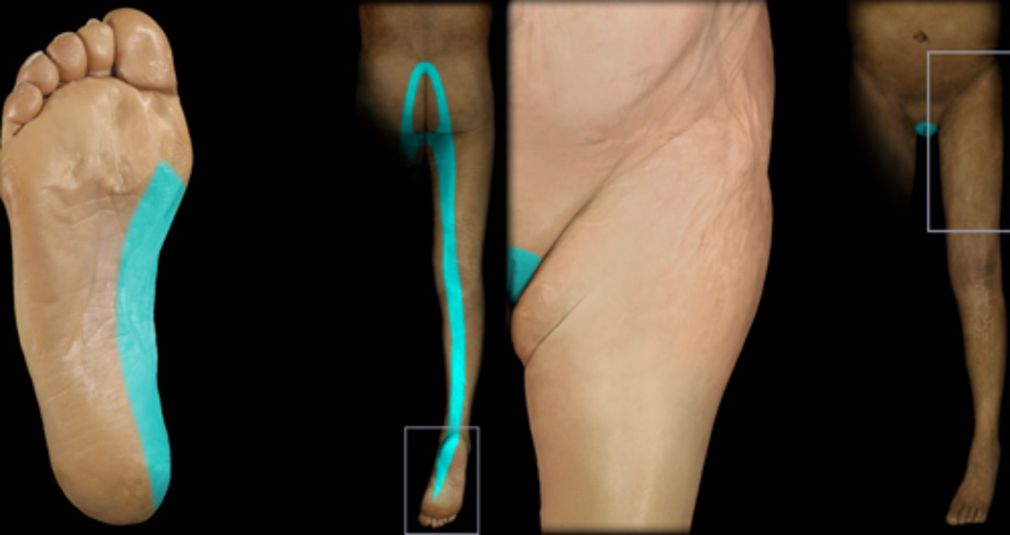 <p>Medial aspect of heel (where heel goes into the arch of the foot)</p>