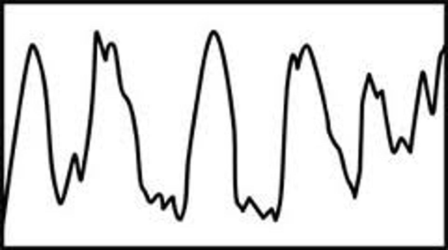 <p>the large, slow brain waves associated with deep sleep</p>