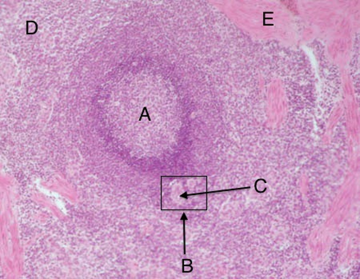 <p>Rich in blood; removes old cells.</p>