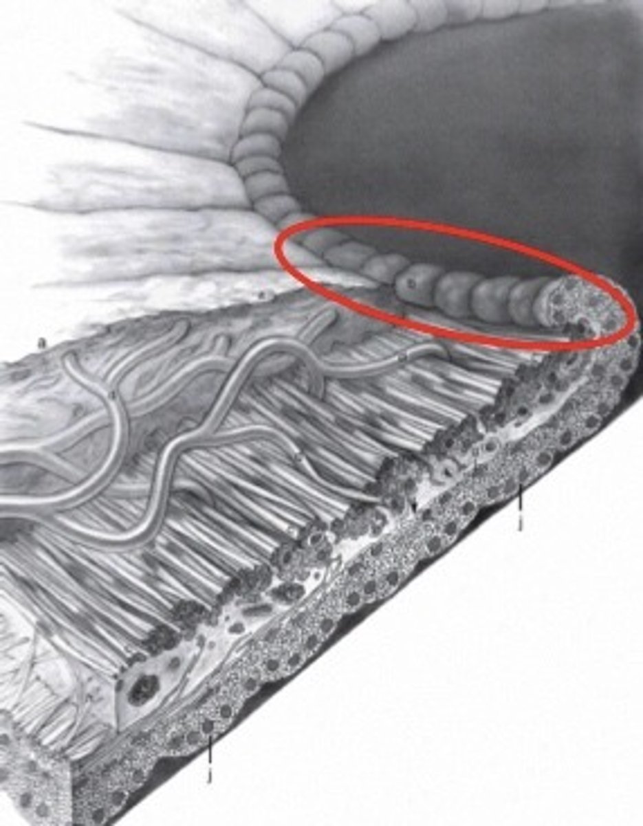<p>Crenated border due to contraction folds of Schwalbe</p><p>-Anterior extension of iris pigmented epithelium</p>