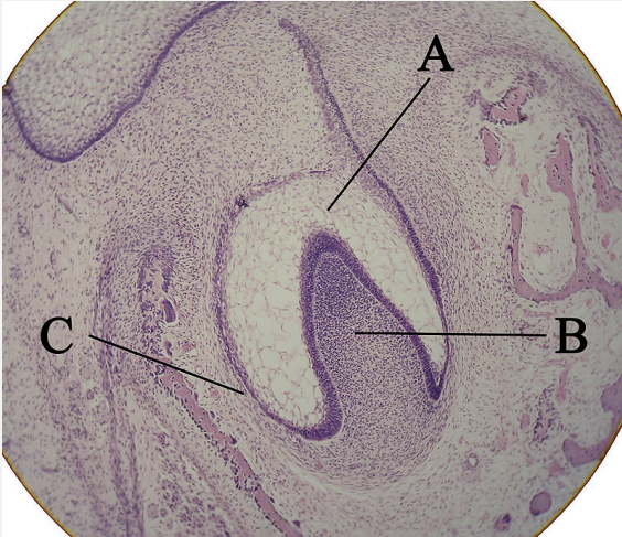 <p><strong><span style="font-family: Times New Roman, serif">Forms in the “Cap Stage”. </span></strong></p><p><strong><span style="font-family: Times New Roman, serif">Tooth germ is composed of the dental follicle, dental papilla, and enamel organ. </span></strong></p><p><strong><span style="font-family: Times New Roman, serif">This cell differentiates specific structures; tooth germ cells specialize into new cells (enamel, dentin, pulp, etc.).</span></strong></p>