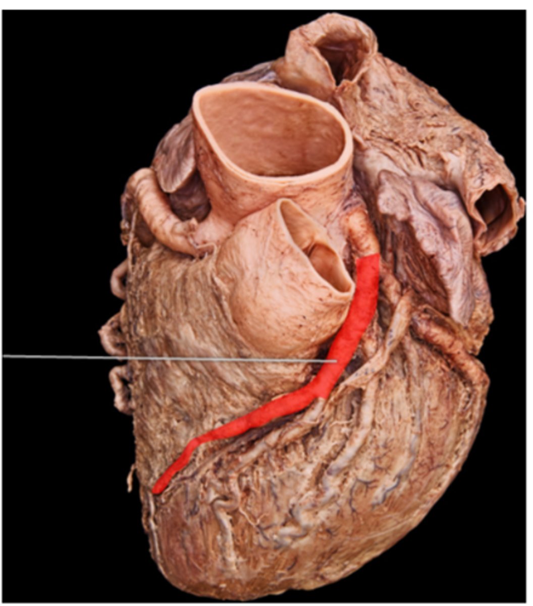 <p>anterior interventricular artery</p>