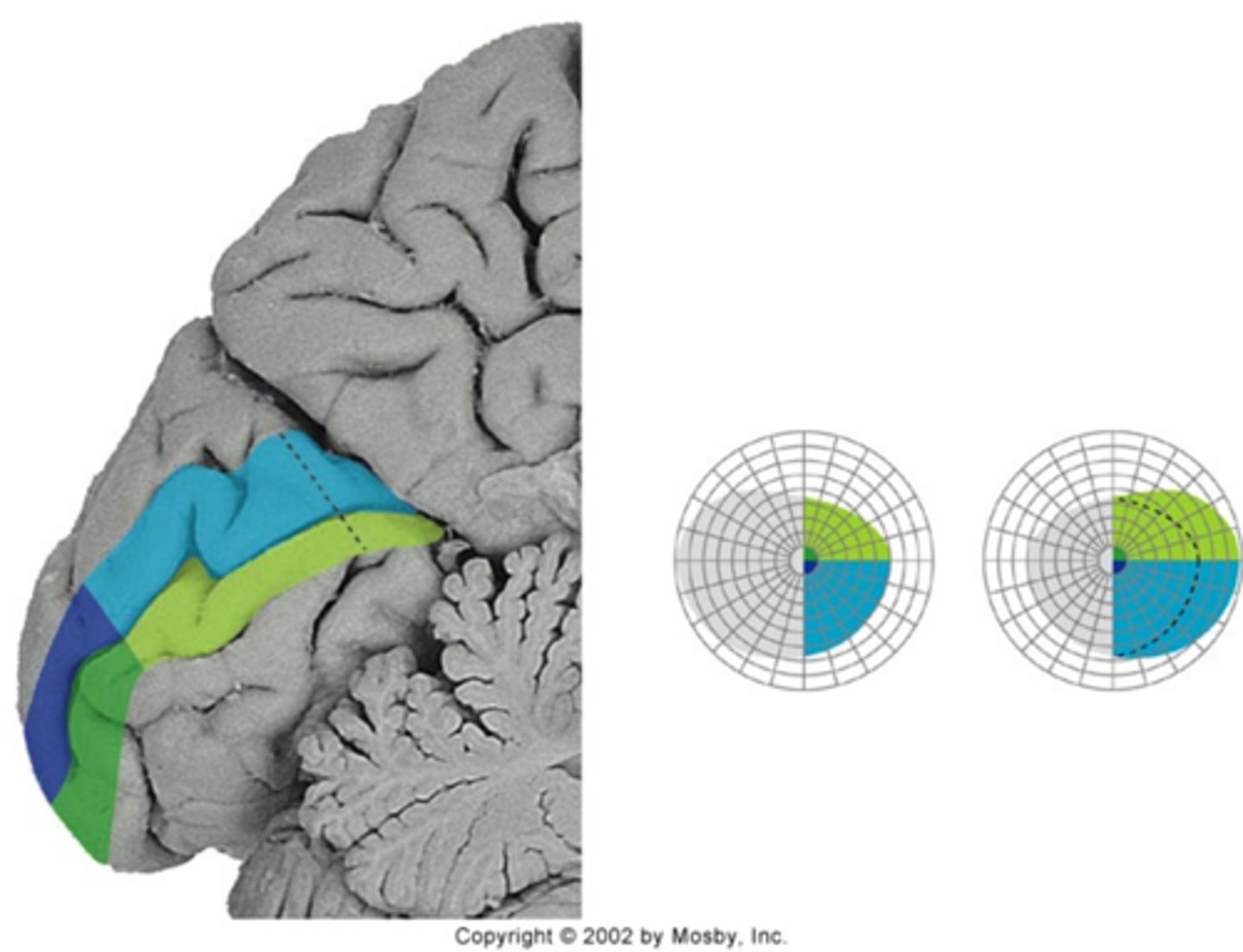<p>Why does the migraine <strong>prodrome</strong> appear to speed up in the periphery?</p>