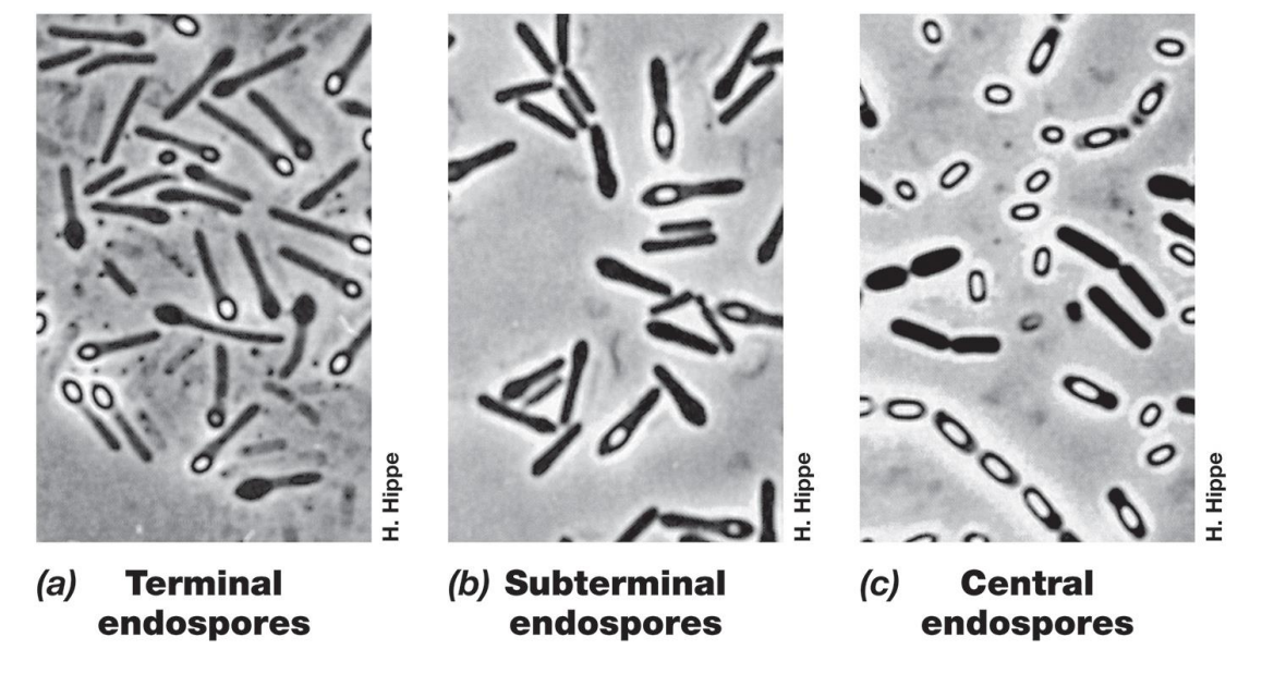 <p>-Survival structures to endure unfavorable growth conditions</p><p>-• Present only in some gram-positive bacteria, (e.g., Bacillus and Clostridium</p><p>•<em><u> Endospore Formation and Germination</u></em></p><p> – can remain dormant for years but converts rapidly back to vegetative</p><p>Ex: C.diff Gram(+),rod shaped, anaerobic bacteria→ release toxins </p>