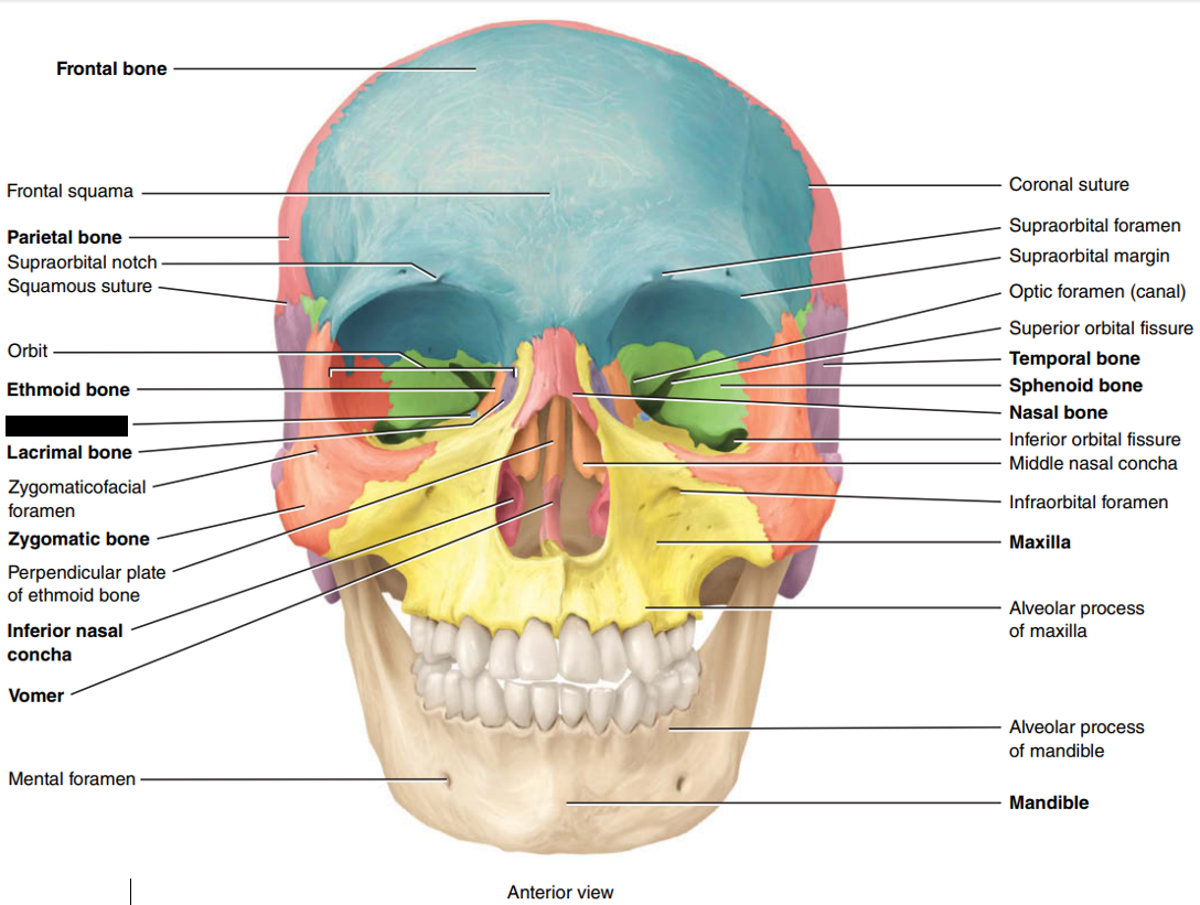 <p>State and identify which part of the cranial bone is being censored.</p>