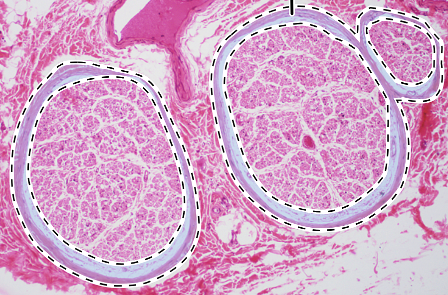 <p>surrounds each fascicle</p>