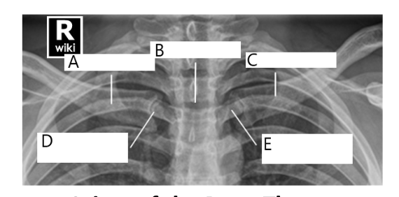 <p>C</p>