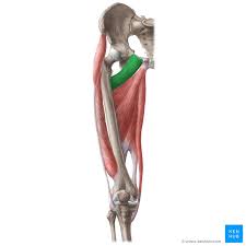 <p>name this muscle, origin and insertion</p>