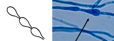 <p>What is the name for this hyphae structure? </p>