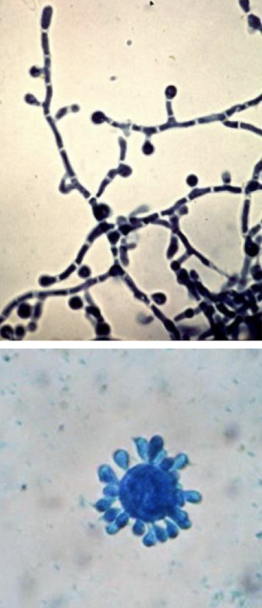 <p>Paracoccidioides brasiliensis</p>