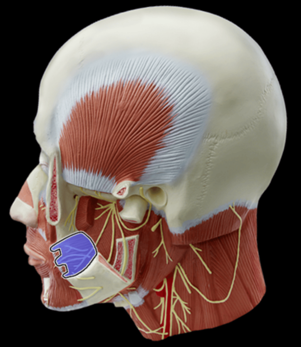 <p>What Muscle Is Highlighted?</p>