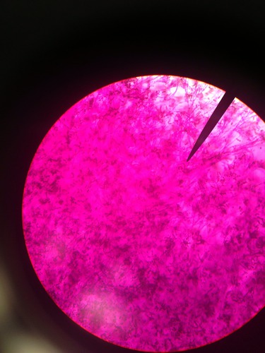 Use as an antibiotic 
(conidiophore stem w round conidia branching off)
Ascomycota