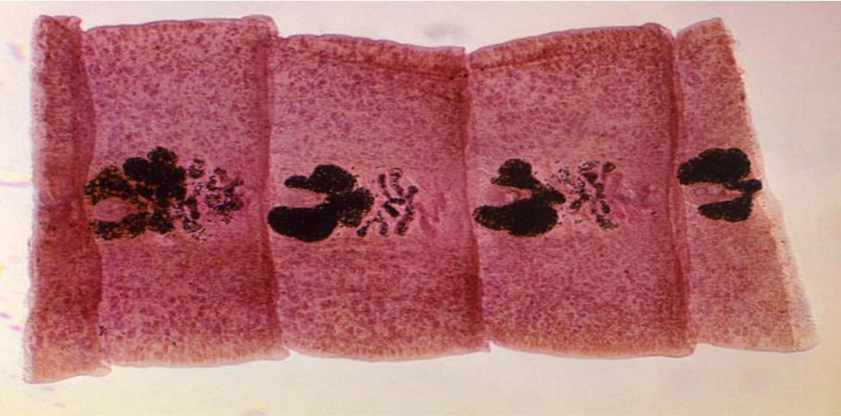 This is a gravid proglottid of a ________________.