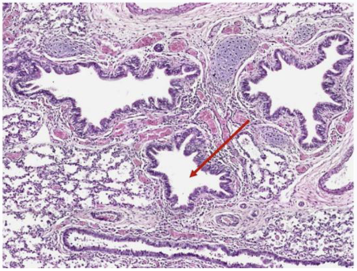 <p>Which of the following cells secrete surfactant in the indicated structure?</p>