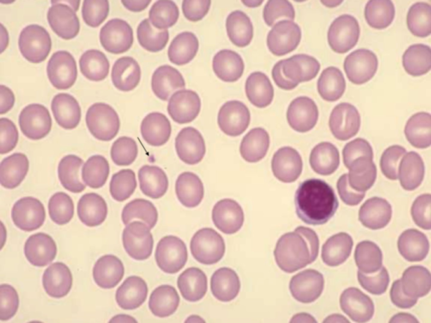 <p>normal size</p><p>(80-100 fL)</p><p>The same size as a small lymphocyte&nbsp;</p>